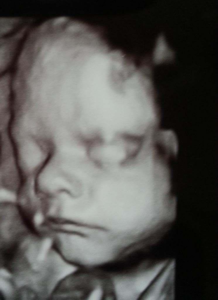 28 week 3D ultrasound pics! BabyCenter